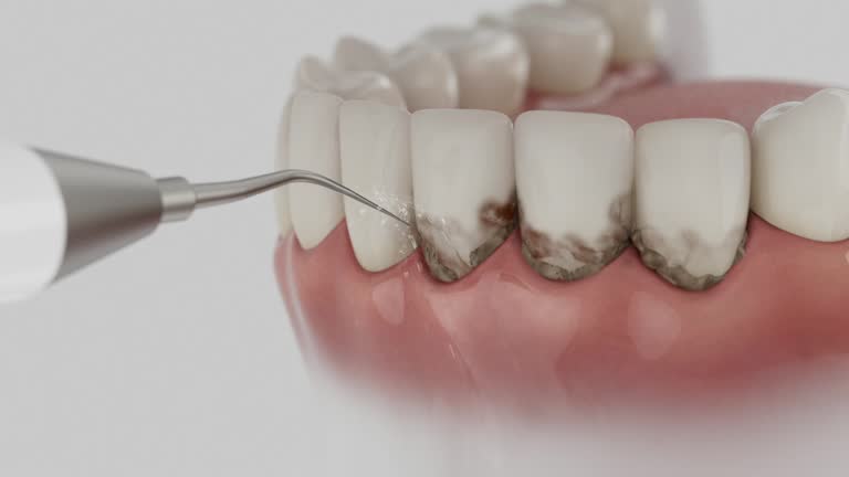 Reliable Dental Implants contractor in Satsuma, AL by Smile Center Dentistry